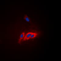 Polyclonal Rabbit anti-Human WAS / WASP Antibody (phospho-Tyr290, IHC, IF, WB)