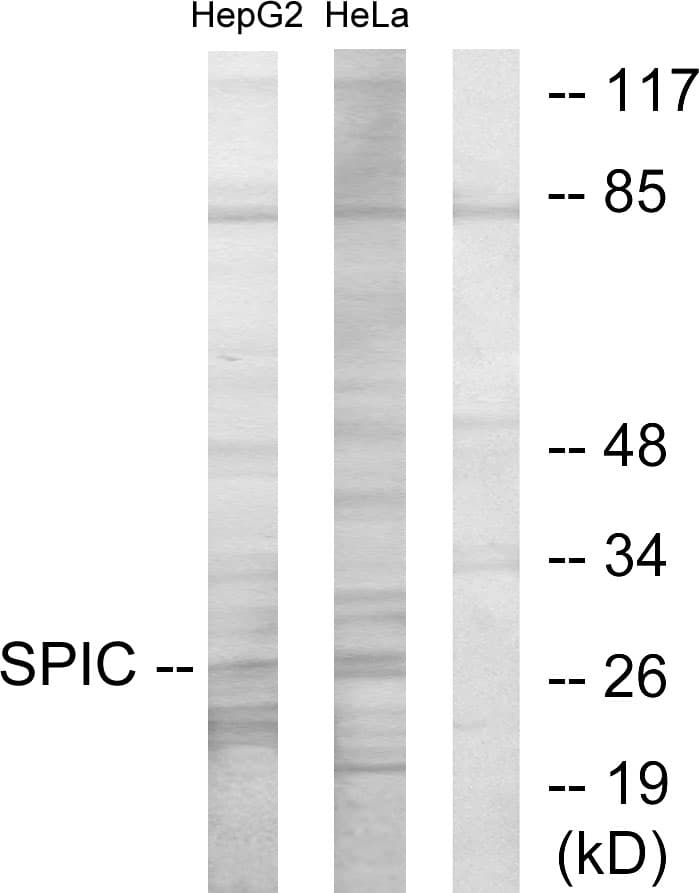 Polyclonal Rabbit anti-Human SPIC Antibody (aa131-180, WB)