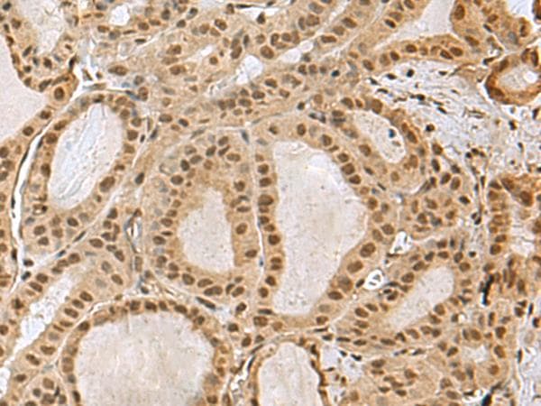 PRPF40A / FNBP3 Antibody