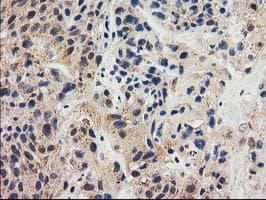 GRHPR / Glyoxylate Reductase Antibody (clone OTI2H4)