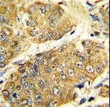 LTA / TNF Beta Antibody (aa46-72)