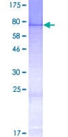 Human ZMYND17 Protein (Recombinant GST)