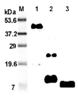 RETNLB / RELM-Beta Antibody (clone MRB 46L)