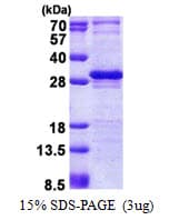 Human Layilin / LAYN Protein (Recombinant His)