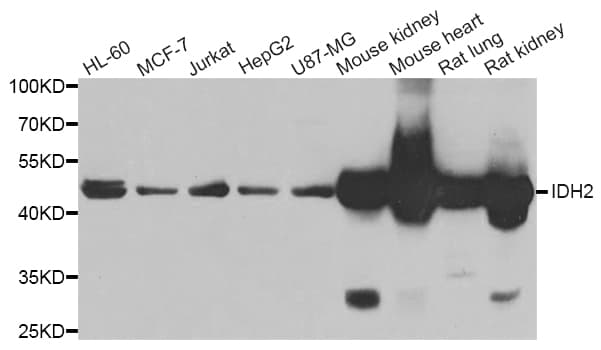 Polyclonal Rabbit anti-Human IDH2 Antibody (IHC, IF, WB)