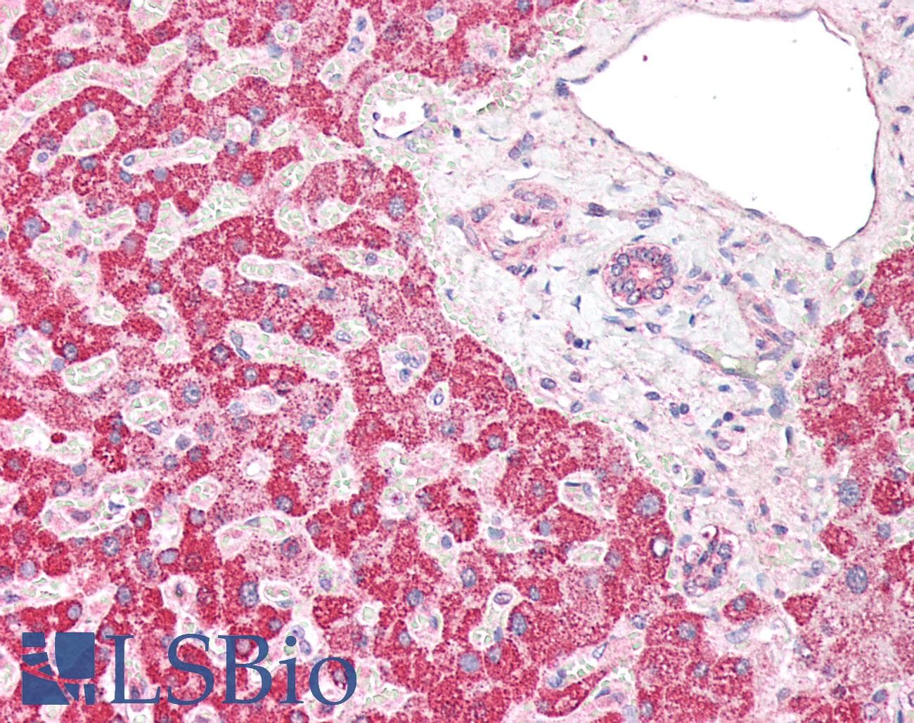 IHC-plus™ HMG-CoA Reductase / HMGCR Antibody