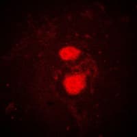 FRK Antibody (Internal)