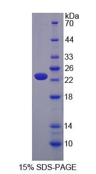 Mouse CACNA1S / Cav1.1 Protein (Recombinant His-S)