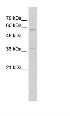 ITGBL1 Antibody (aa151-200, FITC)