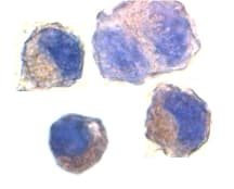 Polyclonal Rabbit anti-Human ADAM10 Antibody (IHC, IF, WB)