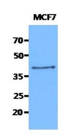 IHC-plus™ Monoclonal Mouse anti-Human KRT19 / CK19 / Cytokeratin 19 Antibody (clone AT13D10, IHC, WB)