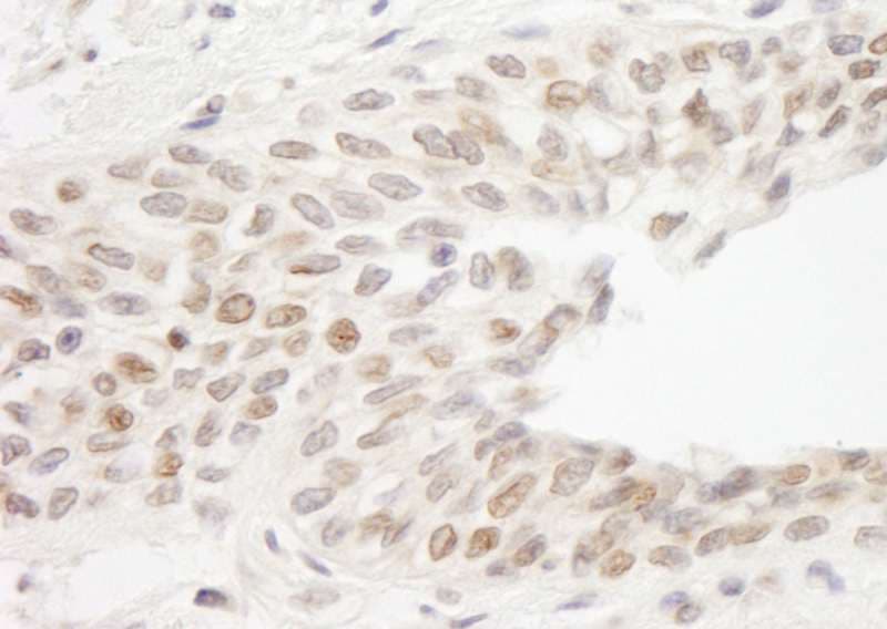 Polyclonal Rabbit anti-Human ATRIP Antibody (aa100-150, IHC, WB)