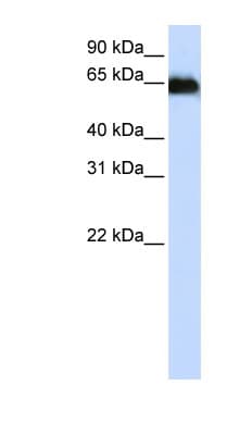 Polyclonal Rabbit anti-Human ADAM12 Antibody (aa216-265, WB)