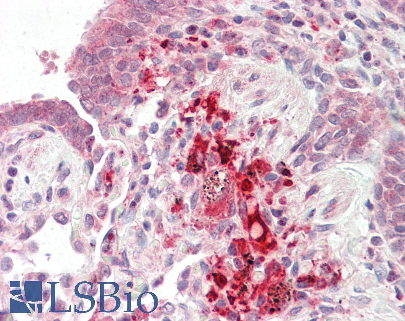 Polyclonal Rabbit anti-Human TRIM72 / MG53 Antibody (aa108-157, IHC, WB)