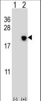 NIP7 Antibody (aa150-177)