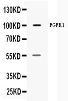 Polyclonal Goat anti-Human FGFR1 / FGF Receptor 1 Antibody (WB)
