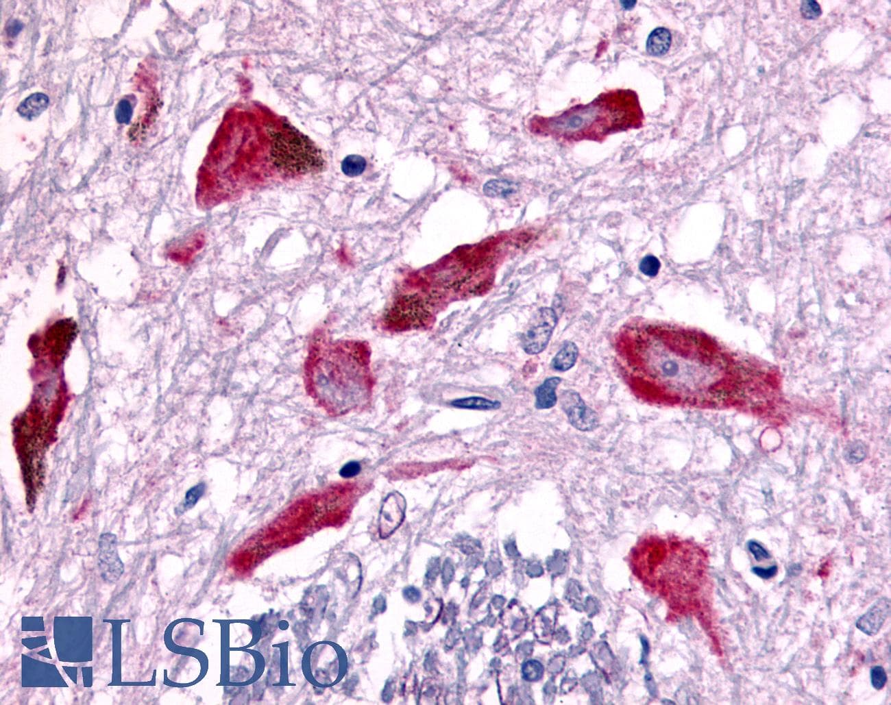 PathPlus™ PAK7/PAK5 Antibody (Internal)