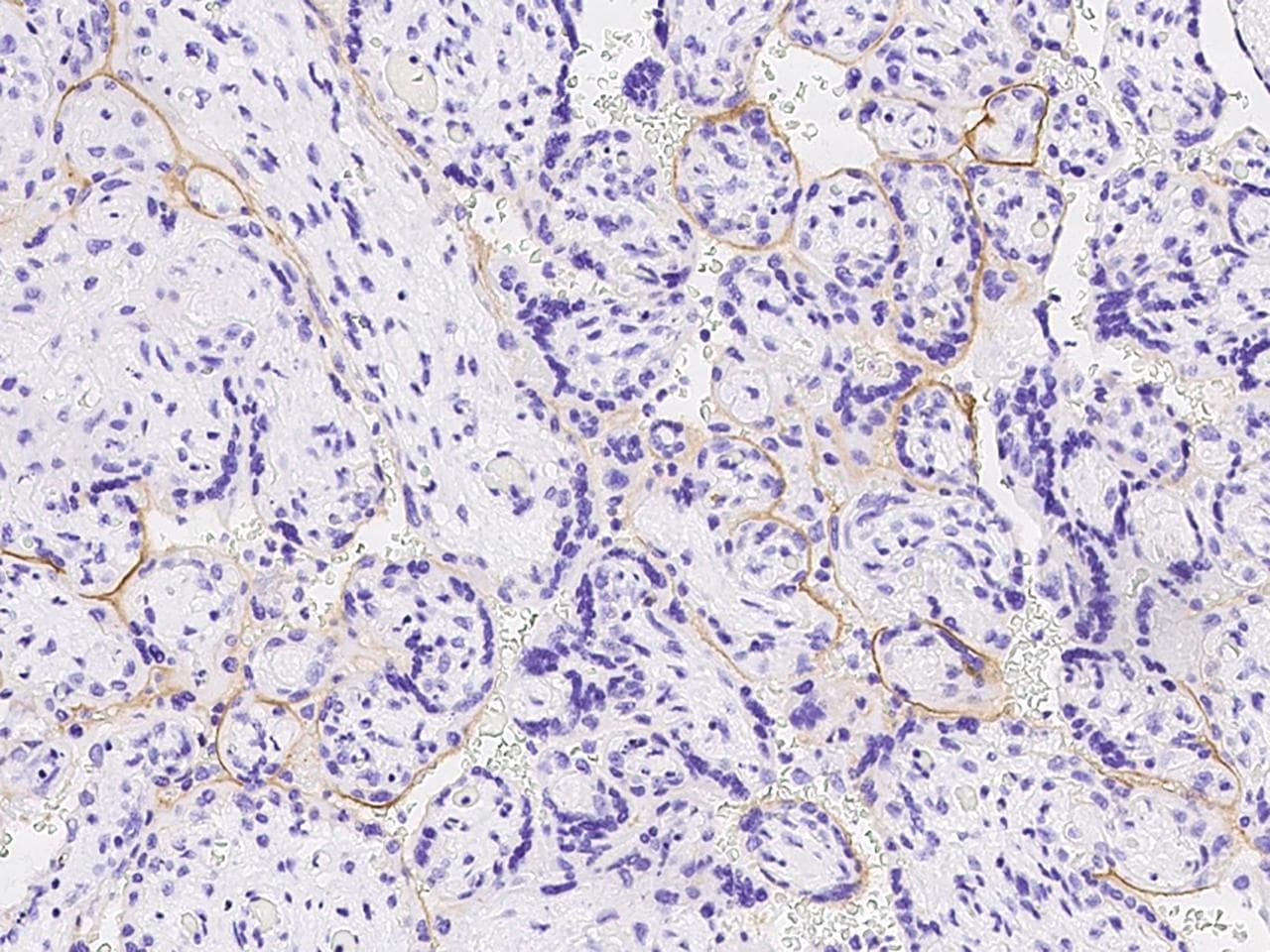 TROP2 / TACSTD2 Antibody