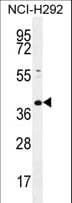 KCTD2 Antibody (aa234-262)
