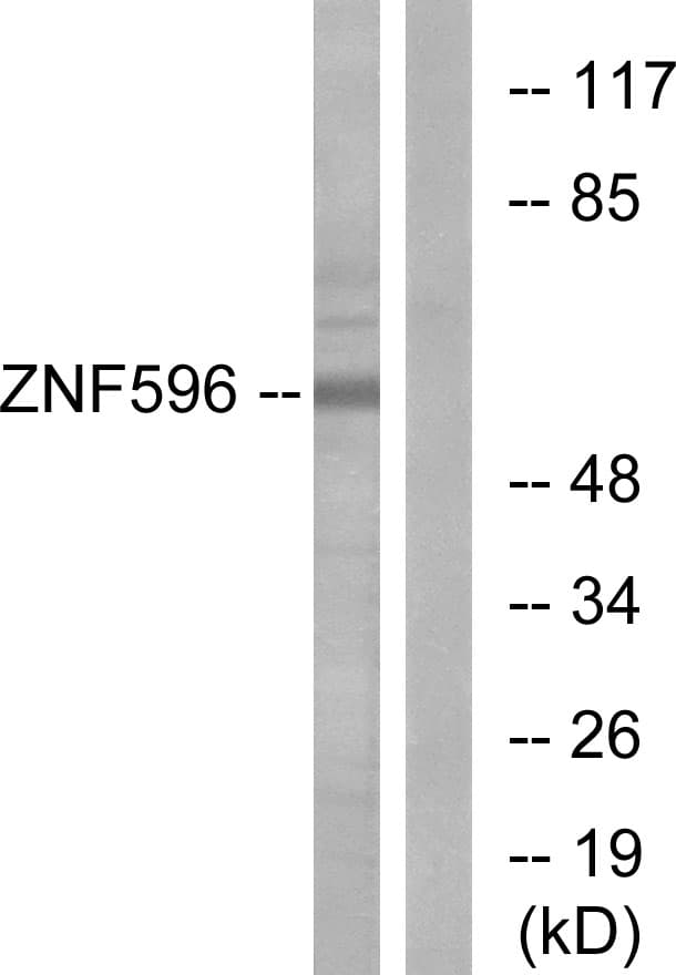IHC-plus™ Polyclonal Rabbit anti-Human ZNF596 Antibody (aa261-310, IHC, WB)