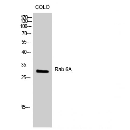 Polyclonal Rabbit anti-Human RAB6A / RAB6 Antibody (90-170 aa, Internal, IHC, WB)