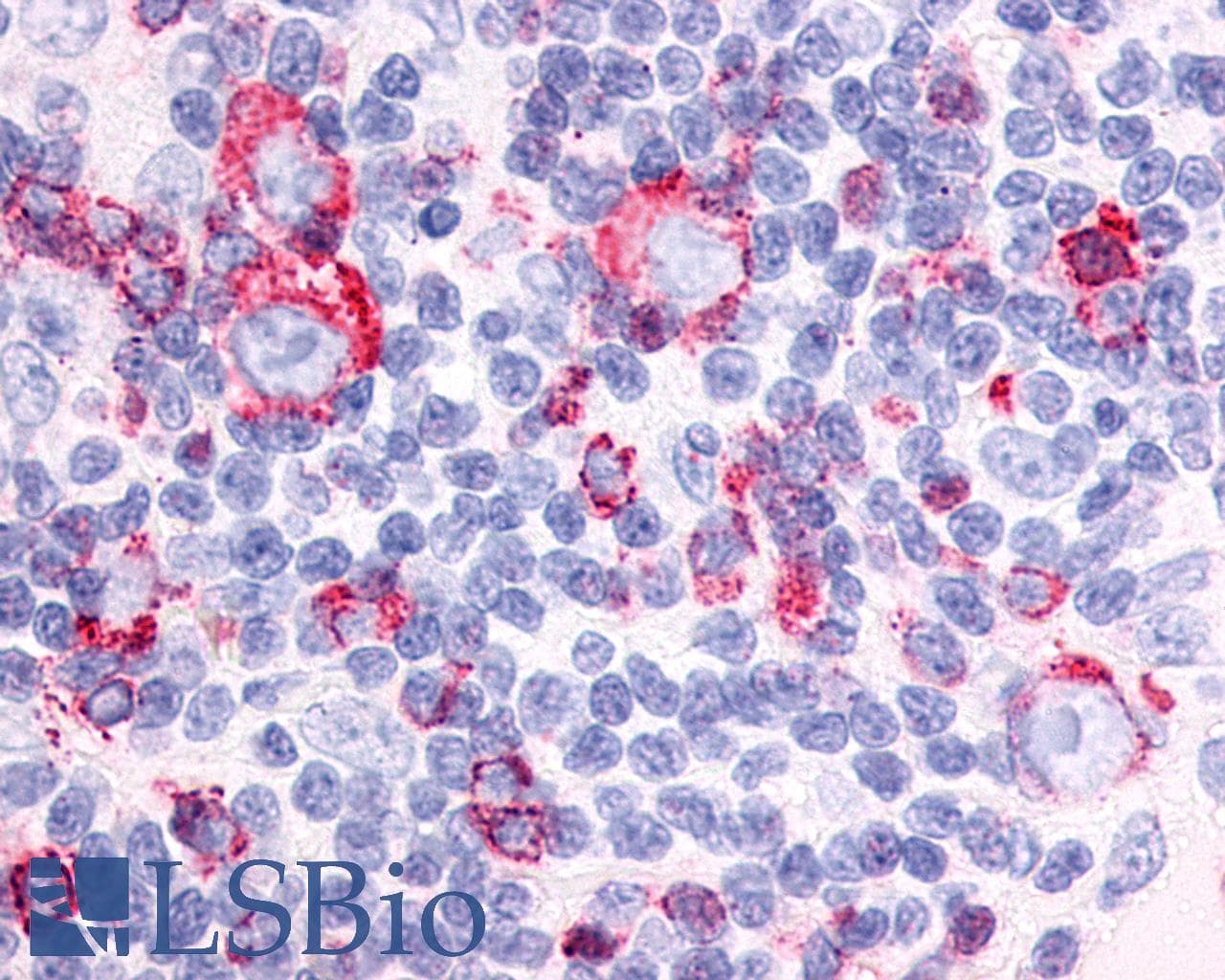 PathPlus™ NPFFR1 / GPR147 Antibody (Extracellular Domain)