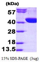 Human ALDOA / Aldolase A Protein (Recombinant His)