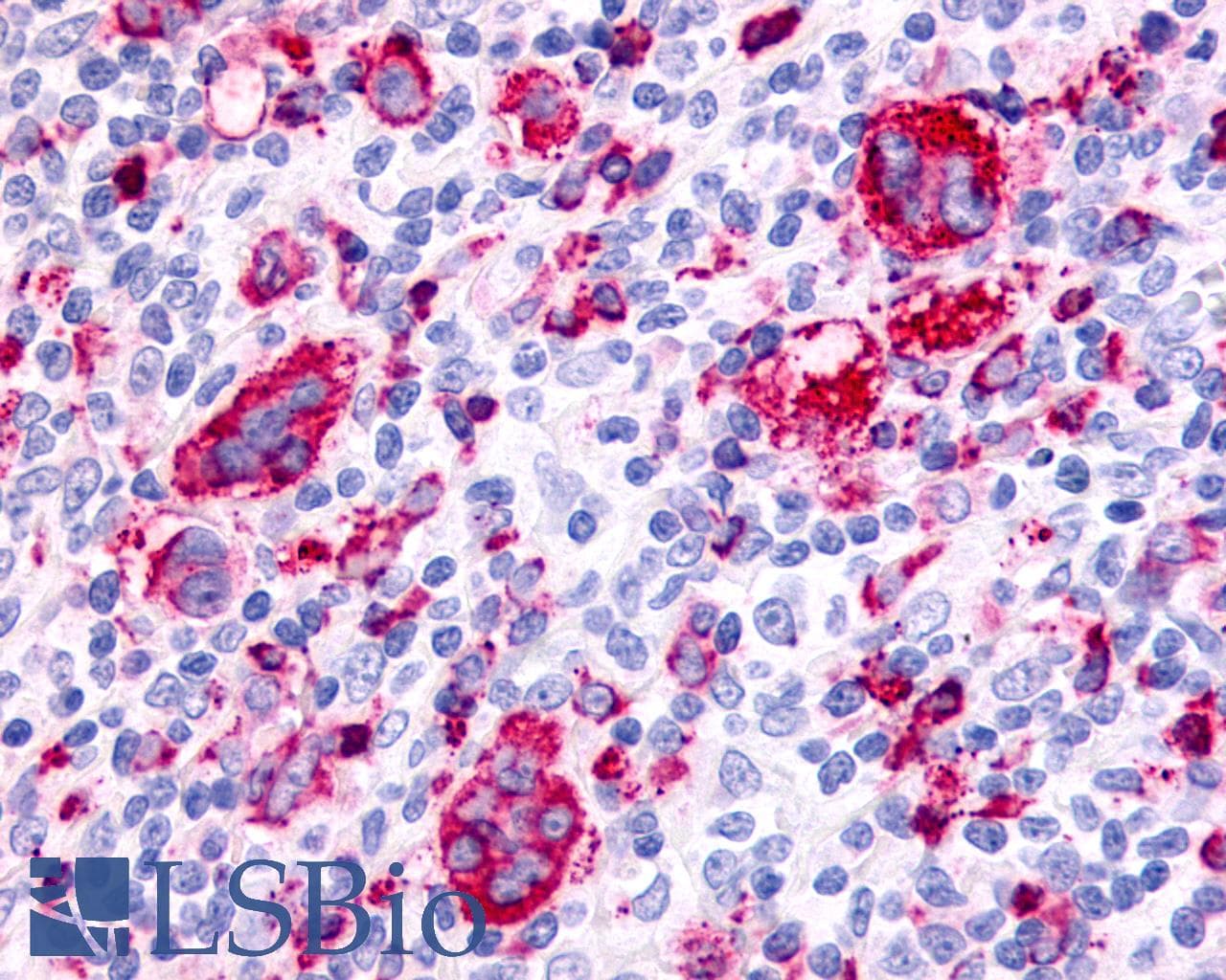 PathPlus™ Polyclonal Rabbit anti-Human F2RL3 / PAR4 Antibody (Extracellular Domain, IHC)