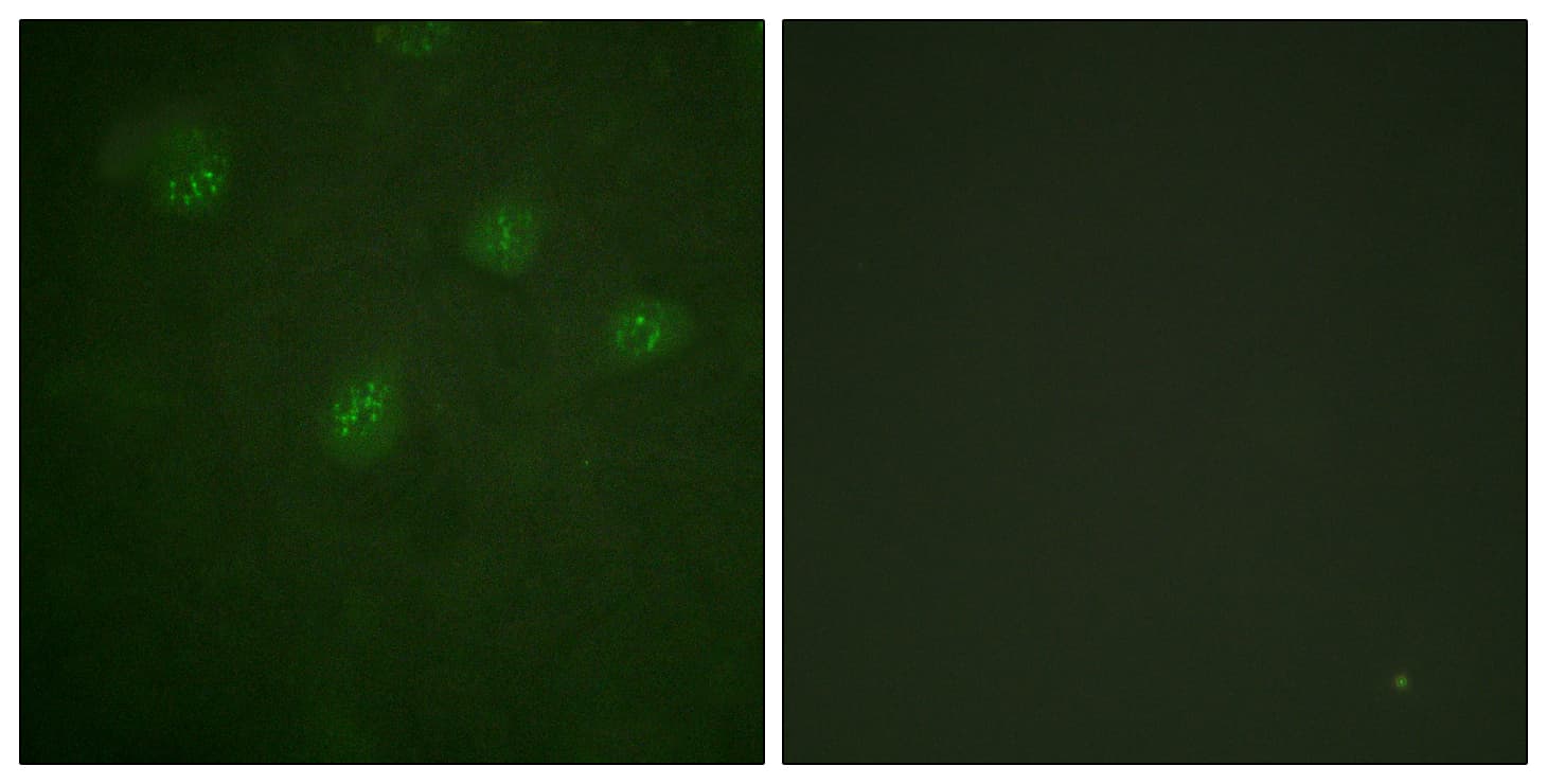 Polyclonal Rabbit anti-Human ER Alpha / Estrogen Receptor Antibody (aa501-550, IHC, IF, WB)