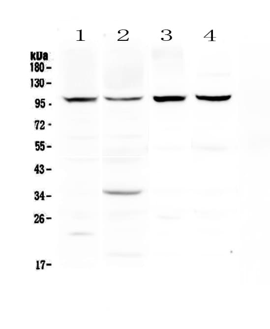 DYRK / DYRK1A Antibody