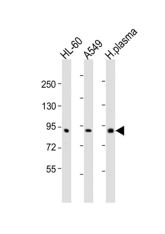 F2 / Prothrombin / Thrombin Antibody (aa46-79)