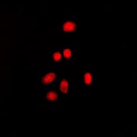 ESR2 / ER Beta Antibody (phospho-Ser105)
