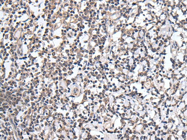 PLAG1 Antibody