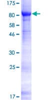 Human SP32 / ACRBP Protein (Recombinant GST)