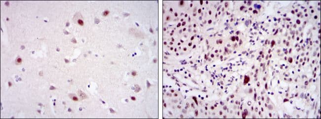 CDK9 Antibody (clone 1B5A7)