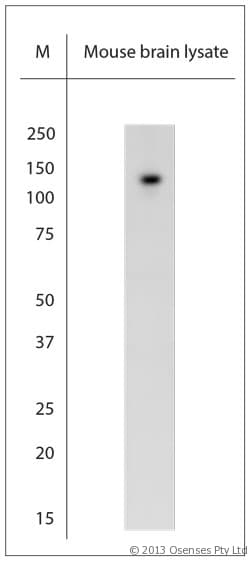 TRPC6 Antibody (aa10-60)