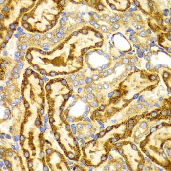 Polyclonal Rabbit anti-Human LAMP3 / CD208 Antibody (IHC, WB)