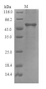 Arabidopsis thaliana DME Protein (Recombinant 6His-SUMO, N-terminus)