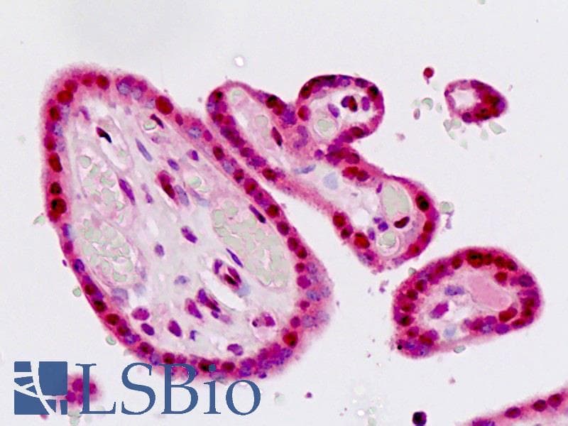 IHC-plus™ Polyclonal Rabbit anti-Human QKI Antibody (aa1-30, IHC, WB)