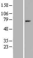 Human CFI / Complement Factor I Protein (Over-Expression Lysate Myc-DDK (Flag))
