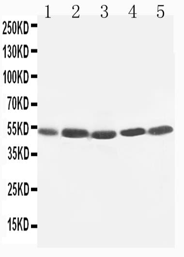 HAVCR1 / KIM-1 Antibody (aa332-348)
