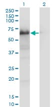 IHC-plus™ Monoclonal Mouse anti-Human YAP / YAP1 Antibody (clone 2F12, IHC, IF, WB)