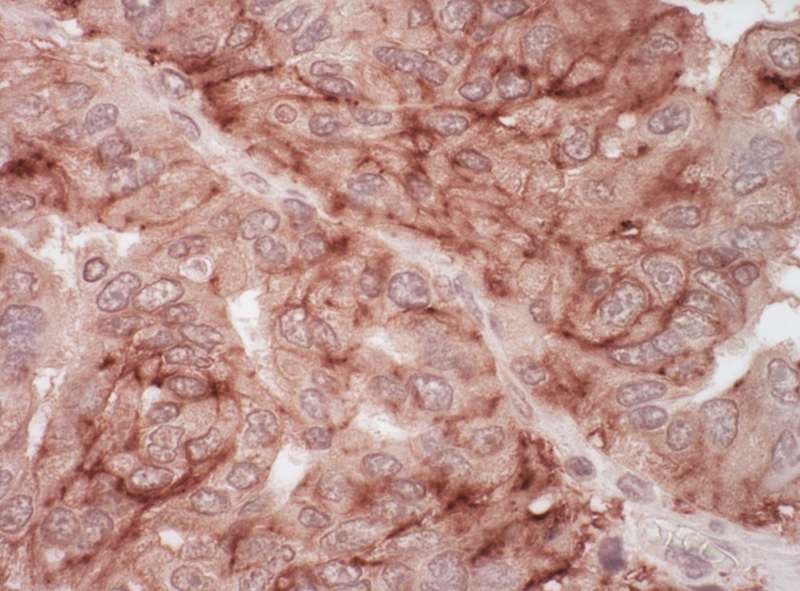 Polyclonal Rabbit anti-Human CXADR Antibody (aa300-335, IHC, WB)