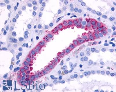 PathPlus™ Polyclonal Rabbit anti-Human ADRA1B / Adrenoceptor alpha 1B Antibody (Cytoplasmic Domain, IHC)