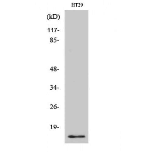CRABP2 Antibody (10-90 aa, Internal)