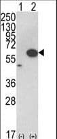 AKT1 Antibody (aa438-468)