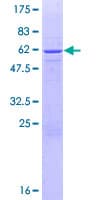 Human DHRS9 Protein (Recombinant GST)