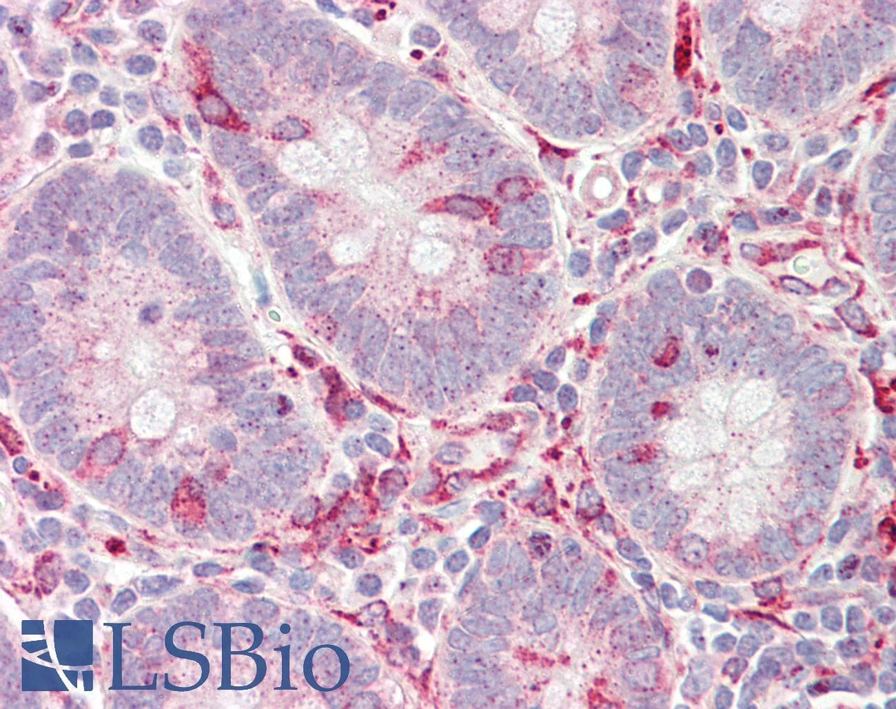 IHC-plus™ Polyclonal Rabbit anti-Human FERMT1 / Kindlin Antibody (aa268-297, IHC, WB)