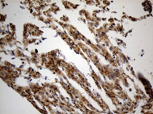 PYGM Antibody (aa698-842, clone OTI3F9)