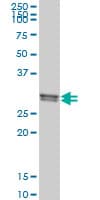 IHC-plus™ CLIC1 / NCC27 Antibody (clone 3F9)